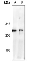 NAV2 Rabbit Polyclonal Antibody