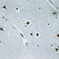 NAV2 Rabbit Polyclonal Antibody