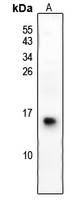 S100-G Rabbit Polyclonal Antibody