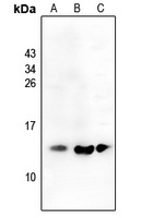 CCL19 Rabbit Polyclonal Antibody