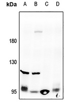 Collagen 2 alpha 1 Rabbit Polyclonal Antibody