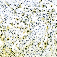 Collagen 2 alpha 1 Rabbit Polyclonal Antibody
