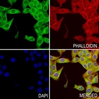 Collagen 2 alpha 1 Rabbit Polyclonal Antibody