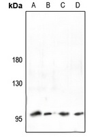 Collagen 2 alpha 1 Rabbit Polyclonal Antibody