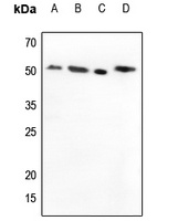 MMP1 Rabbit Polyclonal Antibody