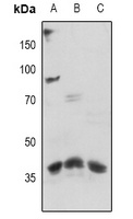EMR2 Rabbit Polyclonal Antibody