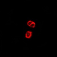 EMR2 Rabbit Polyclonal Antibody