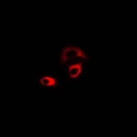 CHRM2 Rabbit Polyclonal Antibody