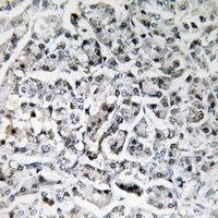 IL-11 Rabbit Polyclonal Antibody