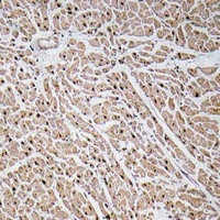 CXCL3 Rabbit Polyclonal Antibody