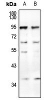 CD66a/b/c Rabbit Polyclonal Antibody