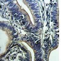 CD66a/b/c Rabbit Polyclonal Antibody