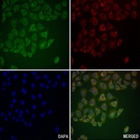 CD66a/b/c Rabbit Polyclonal Antibody