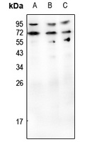 CD70 Rabbit Polyclonal Antibody