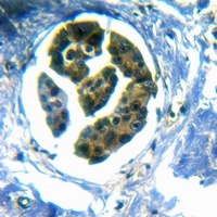 CD70 Rabbit Polyclonal Antibody