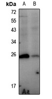 HSP27 (Phospho-S78) Rabbit Polyclonal Antibody