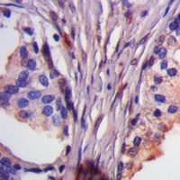 ASK1 (Phospho-T838) Rabbit Polyclonal Antibody