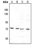 c-RAF (Phospho-S289) Rabbit Polyclonal Antibody