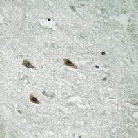 c-RAF (Phospho-S289) Rabbit Polyclonal Antibody