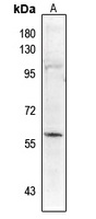 PALF (Phospho-S116) Rabbit Polyclonal Antibody