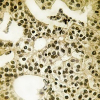 PALF (Phospho-S116) Rabbit Polyclonal Antibody