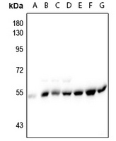 Alpha-tubulin (Phospho-Y272) Rabbit Polyclonal Antibody