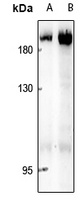 ABL1/2 Rabbit Polyclonal Antibody