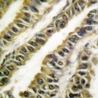 ABL1/2 Rabbit Polyclonal Antibody