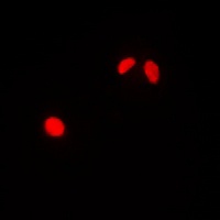 TRAP220 Rabbit Polyclonal Antibody