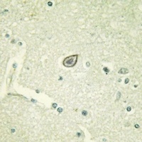 CD115 Rabbit Polyclonal Antibody