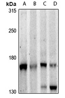 PLC beta 3 Rabbit Polyclonal Antibody