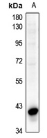 CD95 Rabbit Polyclonal Antibody