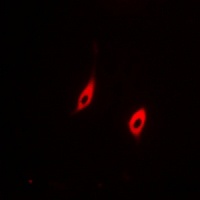 CD95 Rabbit Polyclonal Antibody