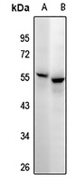 CD25 Rabbit Polyclonal Antibody