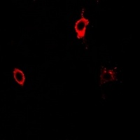 CD25 Rabbit Polyclonal Antibody