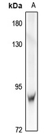 IRAK1 Rabbit Polyclonal Antibody
