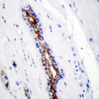 IRAK1 Rabbit Polyclonal Antibody
