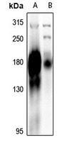 EGFR Rabbit Polyclonal Antibody