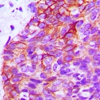 EGFR Rabbit Polyclonal Antibody