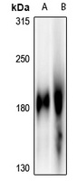EGFR Rabbit Polyclonal Antibody