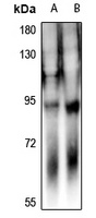 DAB1 Rabbit Polyclonal Antibody
