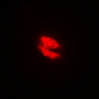 DAB1 Rabbit Polyclonal Antibody