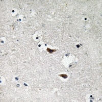 c-SRC Rabbit Polyclonal Antibody