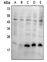 SKP1 Rabbit Polyclonal Antibody