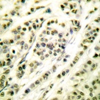 SKP1 Rabbit Polyclonal Antibody