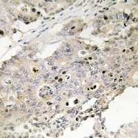 TAF4 Rabbit Polyclonal Antibody