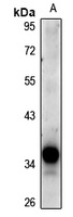 DCR3 Rabbit Polyclonal Antibody