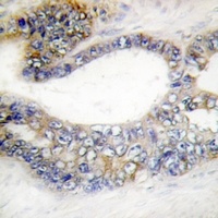 DCR3 Rabbit Polyclonal Antibody