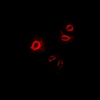 DCR3 Rabbit Polyclonal Antibody