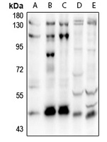 SOX8 Rabbit Polyclonal Antibody